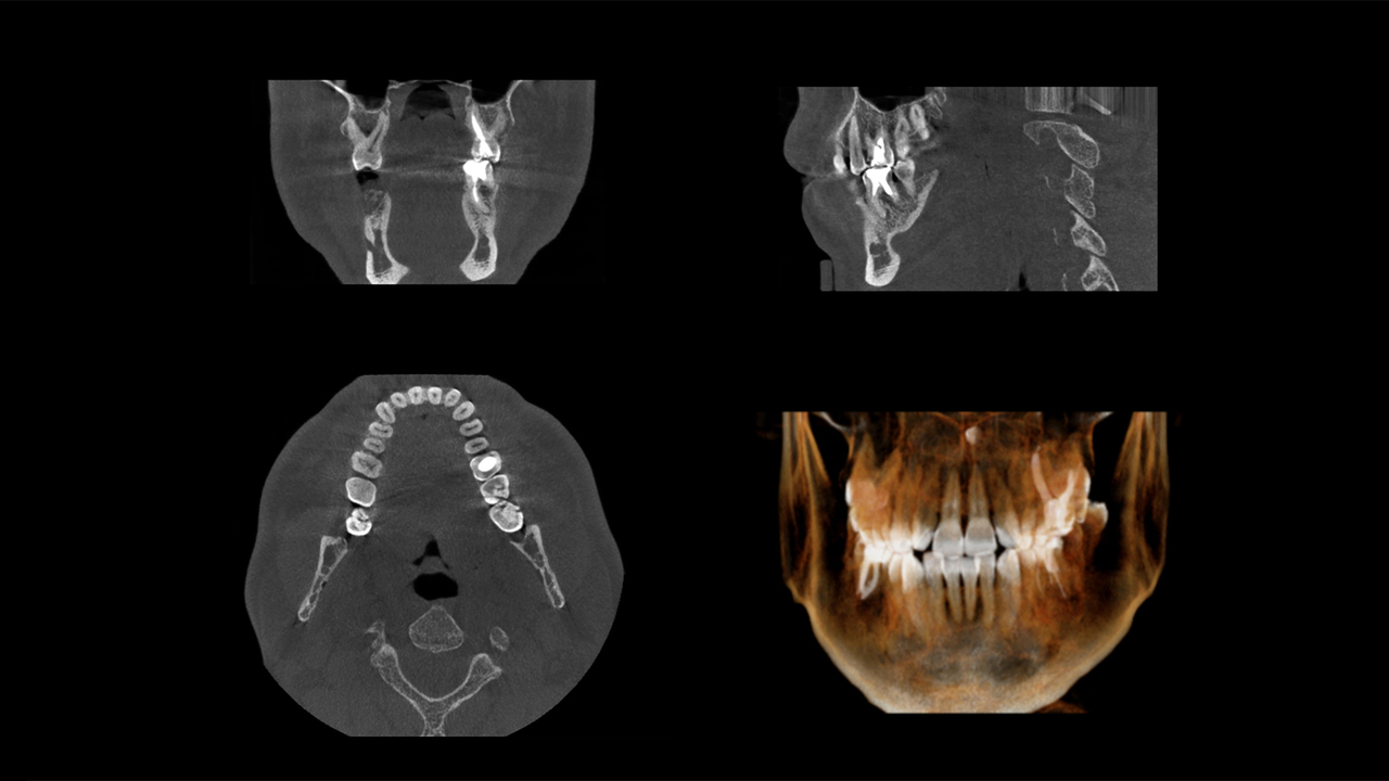 大阪市鶴見区の歯科用CTについて