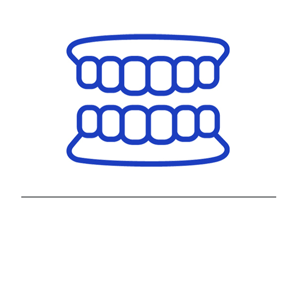 大阪市鶴見区のノンクラスプデンチャー