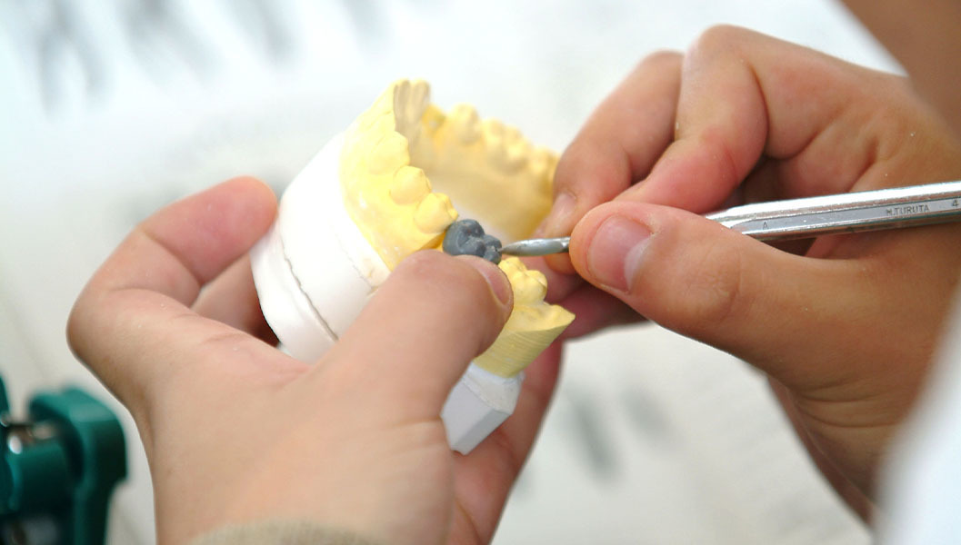 大阪市鶴見区の入れ歯治療