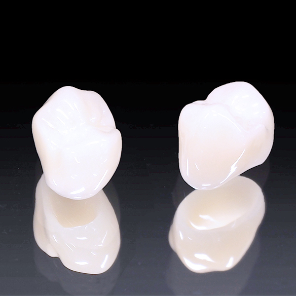 大阪市鶴見区のCAD/CAM（保険の白い詰め物・被せ物）