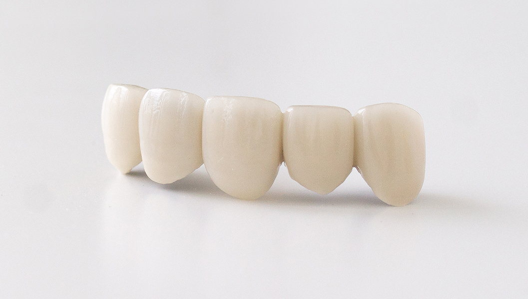 大阪市鶴見区の審美歯科