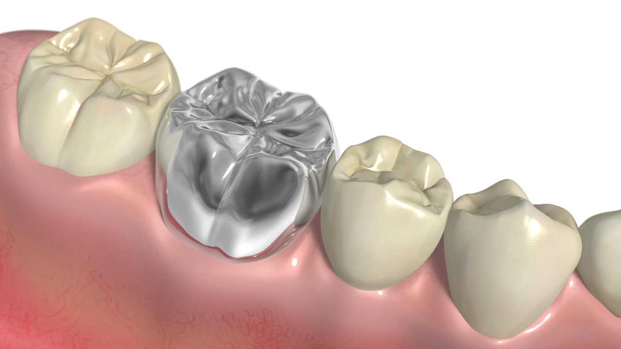 大阪市鶴見区の審美歯科