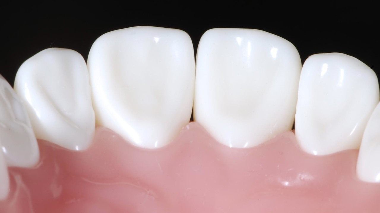 大阪市鶴見区の審美歯科