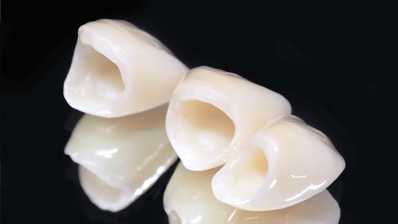 大阪市鶴見区の審美歯科