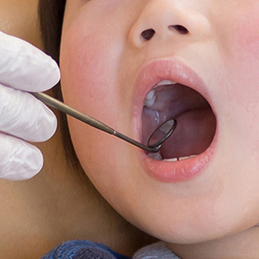 大阪市鶴見区の小児の予防歯科