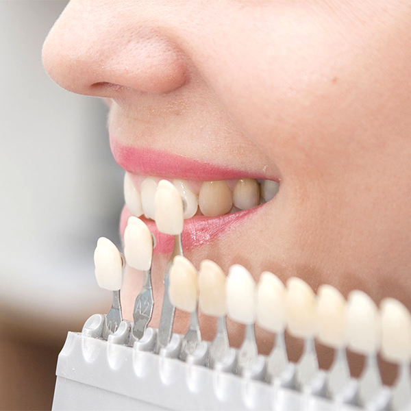 大阪市鶴見区の審美歯科