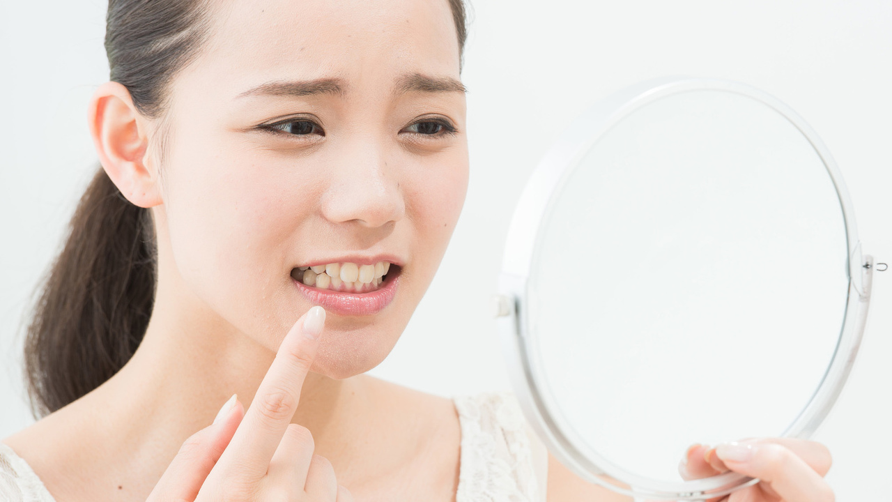 大阪市鶴見区の歯ぎしり・食いしばりの治療（ナイトガード）