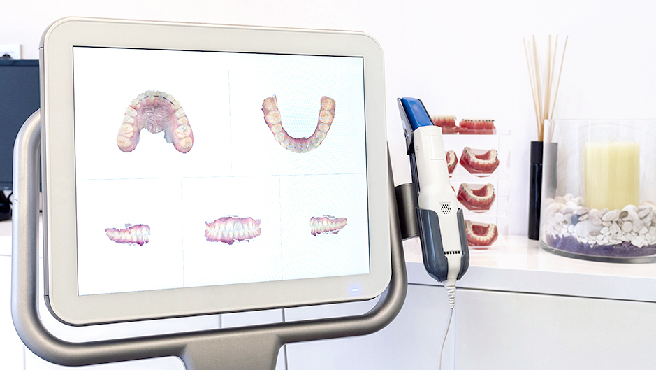 大阪市鶴見区のマウスピース矯正（インビザラインGO）