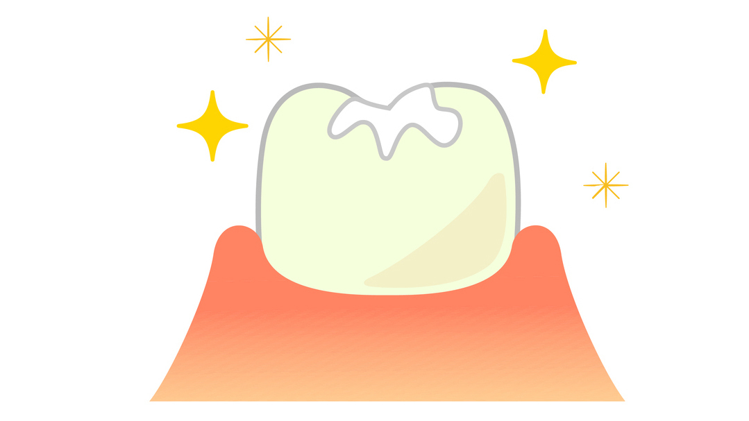 大阪市鶴見区のシーラント