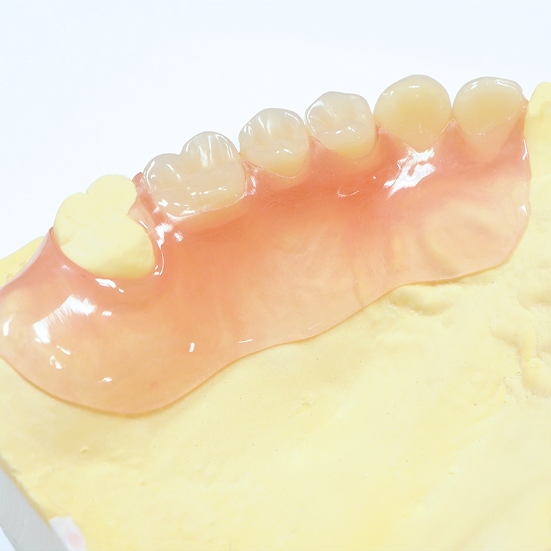 大阪市鶴見区の入れ歯治療