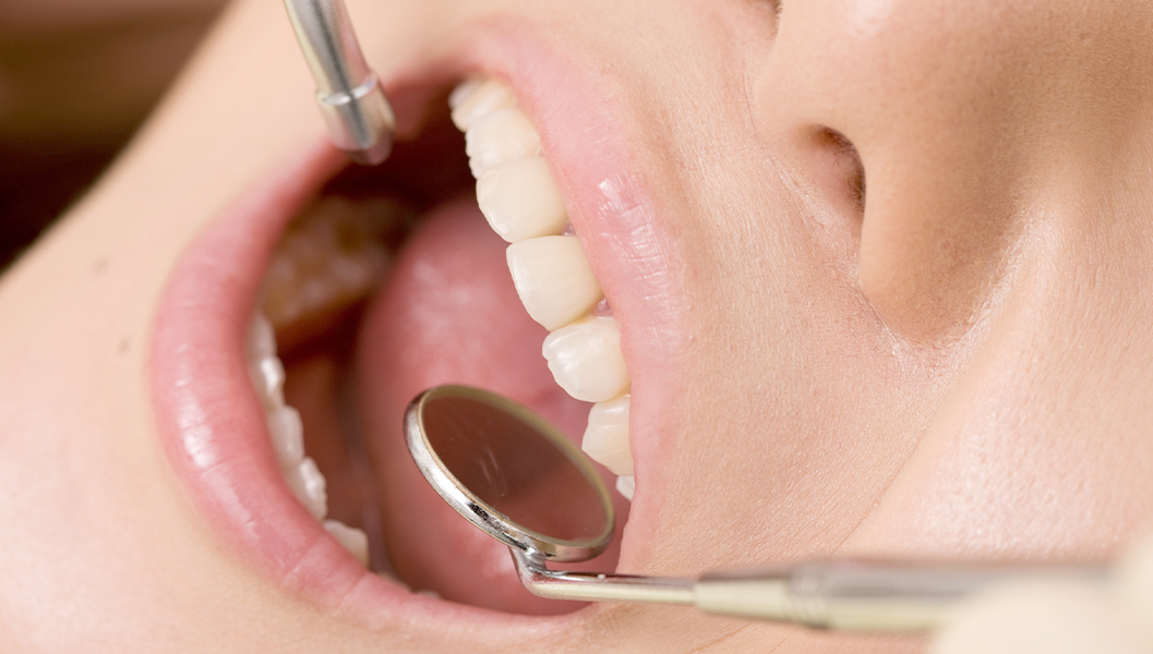 大阪市鶴見区の審美歯科