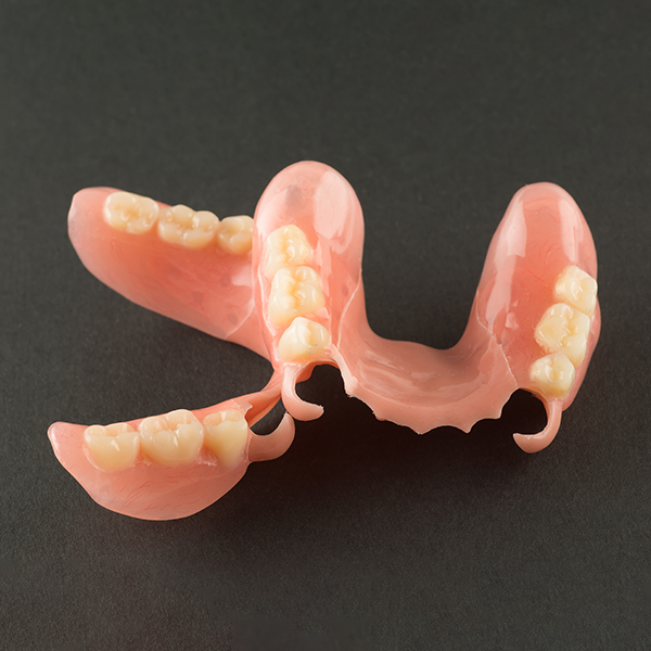 大阪市鶴見区のノンクラスプデンチャー