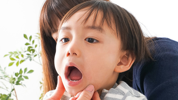 大阪市鶴見区の小児の予防歯科