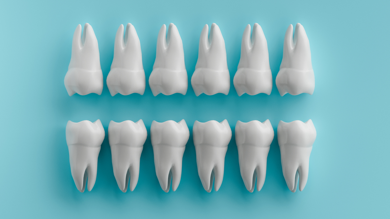大阪市鶴見区の歯ぎしり・食いしばりの治療（ナイトガード）