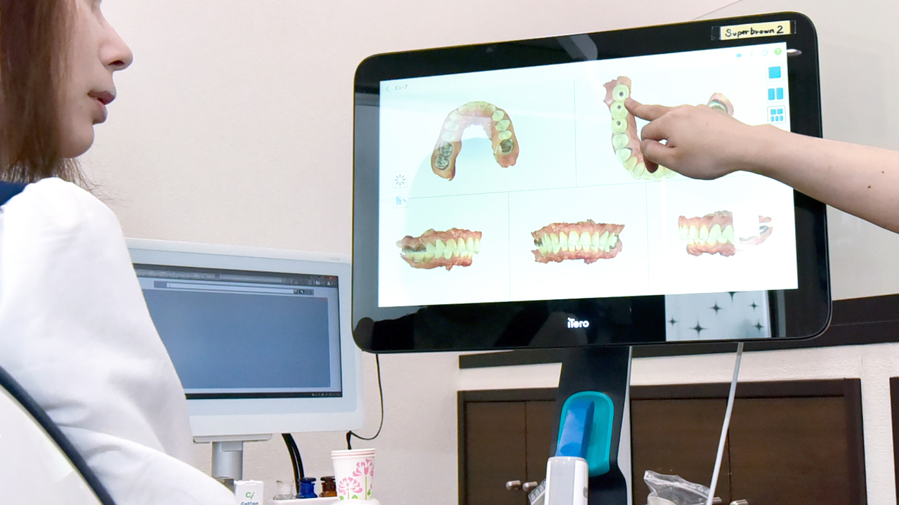 大阪市鶴見区のマウスピース矯正（インビザラインGO）